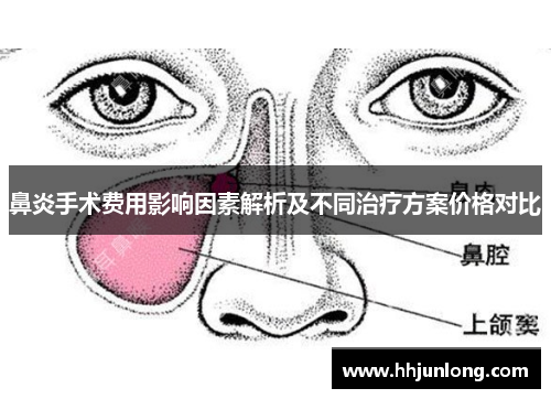 鼻炎手术费用影响因素解析及不同治疗方案价格对比